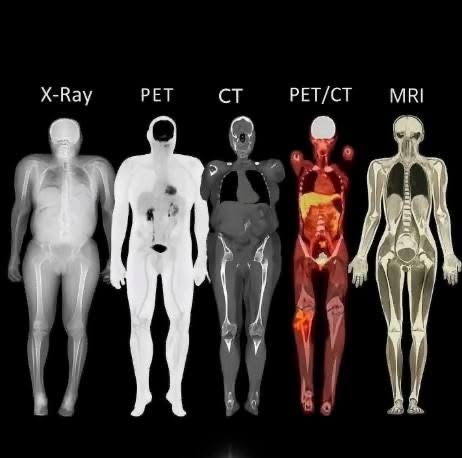 CT là gì? PET/CT là gì? MRI là gì? Phân biệt các phương pháp chẩn đoán hình ảnh trong ung thư - hình minh họa 3