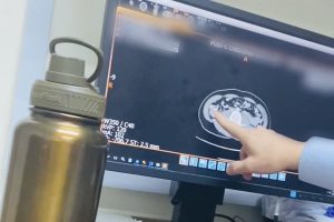 Xem phim chụp y khoa trên màn hình máy tính