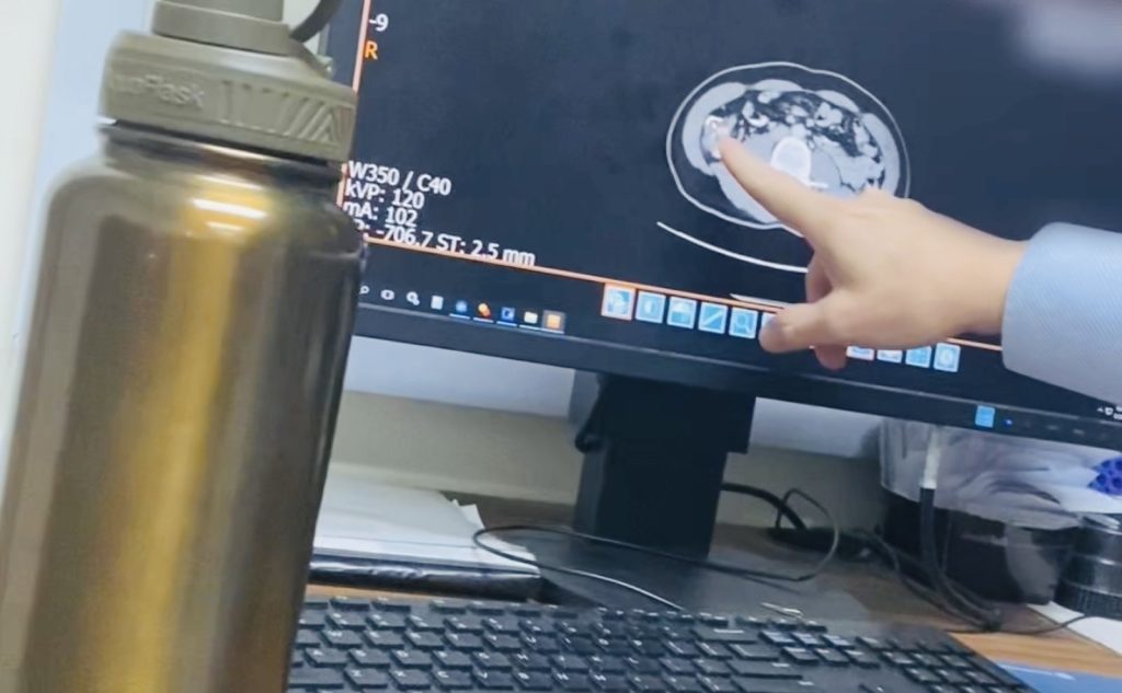 Xem phim chụp y khoa trên màn hình máy tính