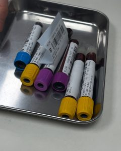 7 dấu hiệu ung thư gan không nên bỏ qua