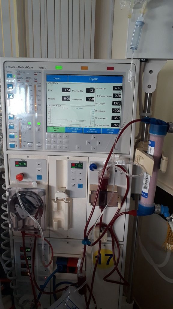 Bạch cầu cấp dòng tuỷ AML: Khi ý kiến y khoa thứ hai mở ra thêm lựa chọn cho bệnh nhân bên cạnh ghép tủy - hình minh họa 1