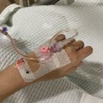 Ung thư tuỵ – 2 kiểu đau rất dễ bị nhầm lẫn và bỏ qua