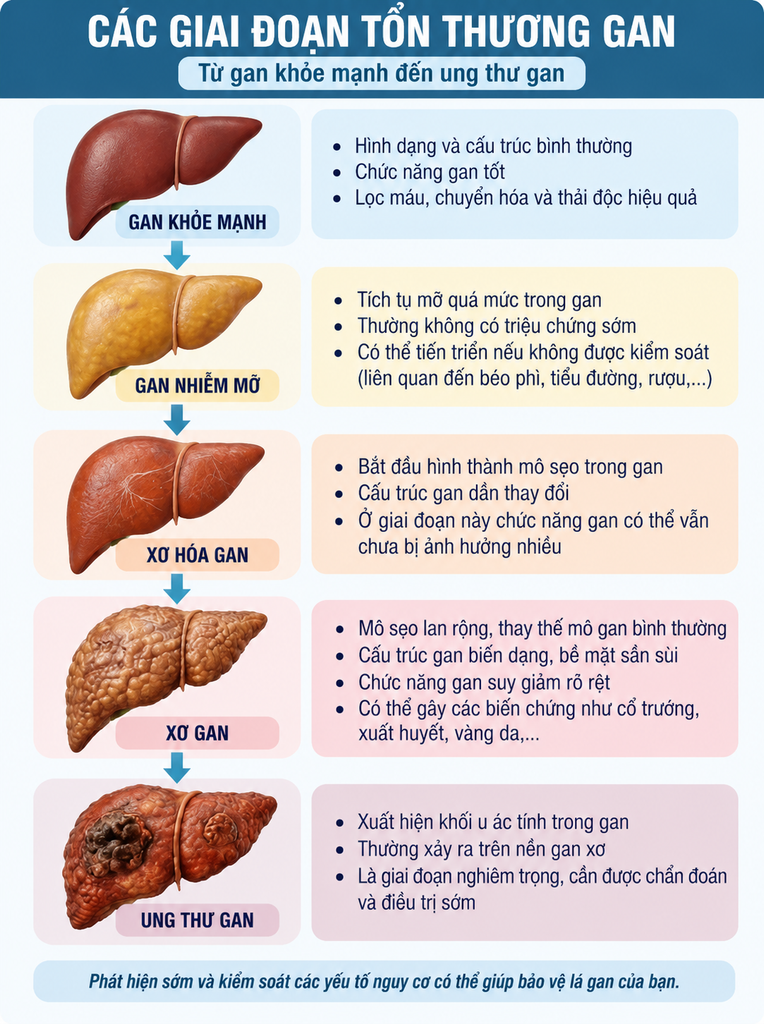 Ung thư gan là gì? Nguyên nhân, dấu hiệu, chẩn đoán và điều trị - hình minh họa 1