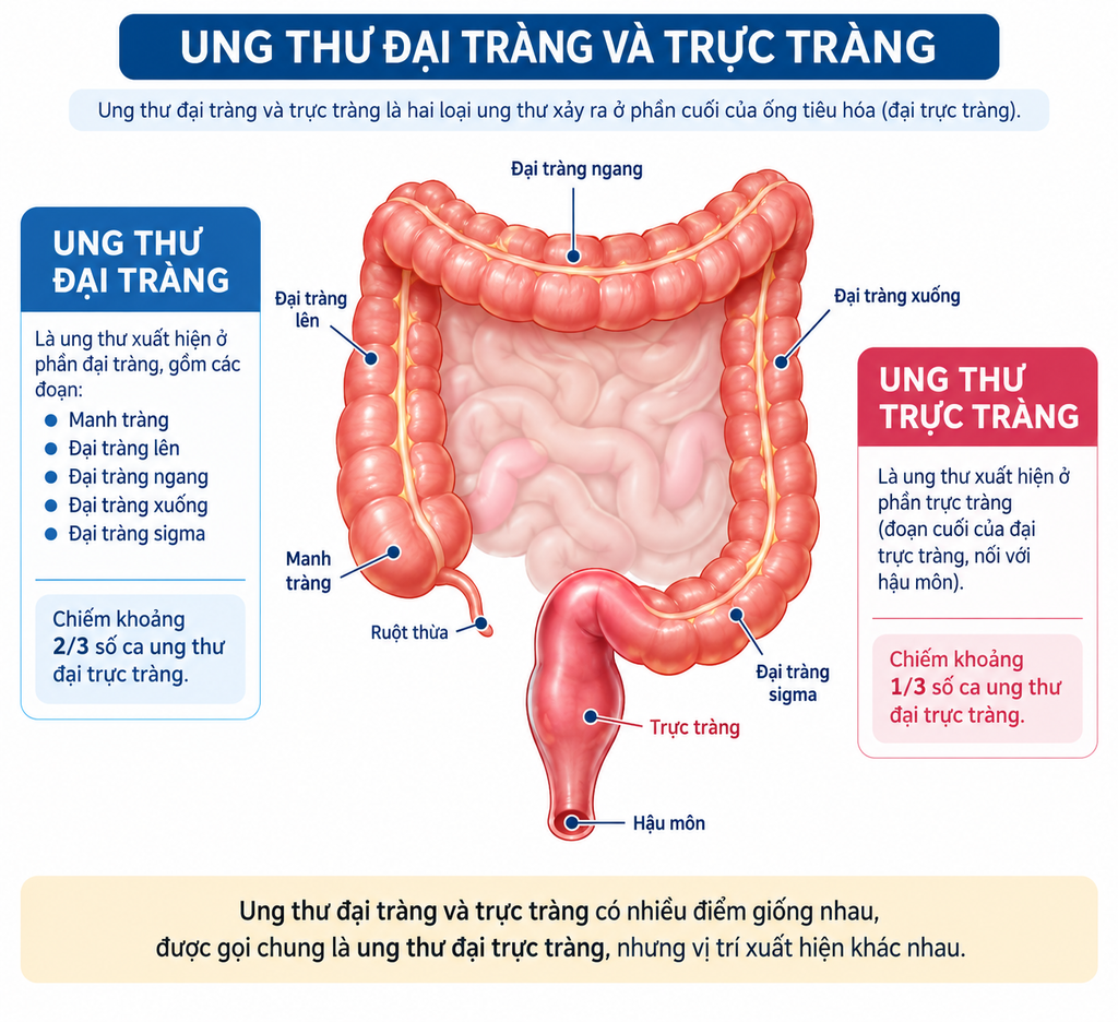 Ung thư đại tràng và ung thư trực tràng khác nhau như thế nào? - hình minh họa 1