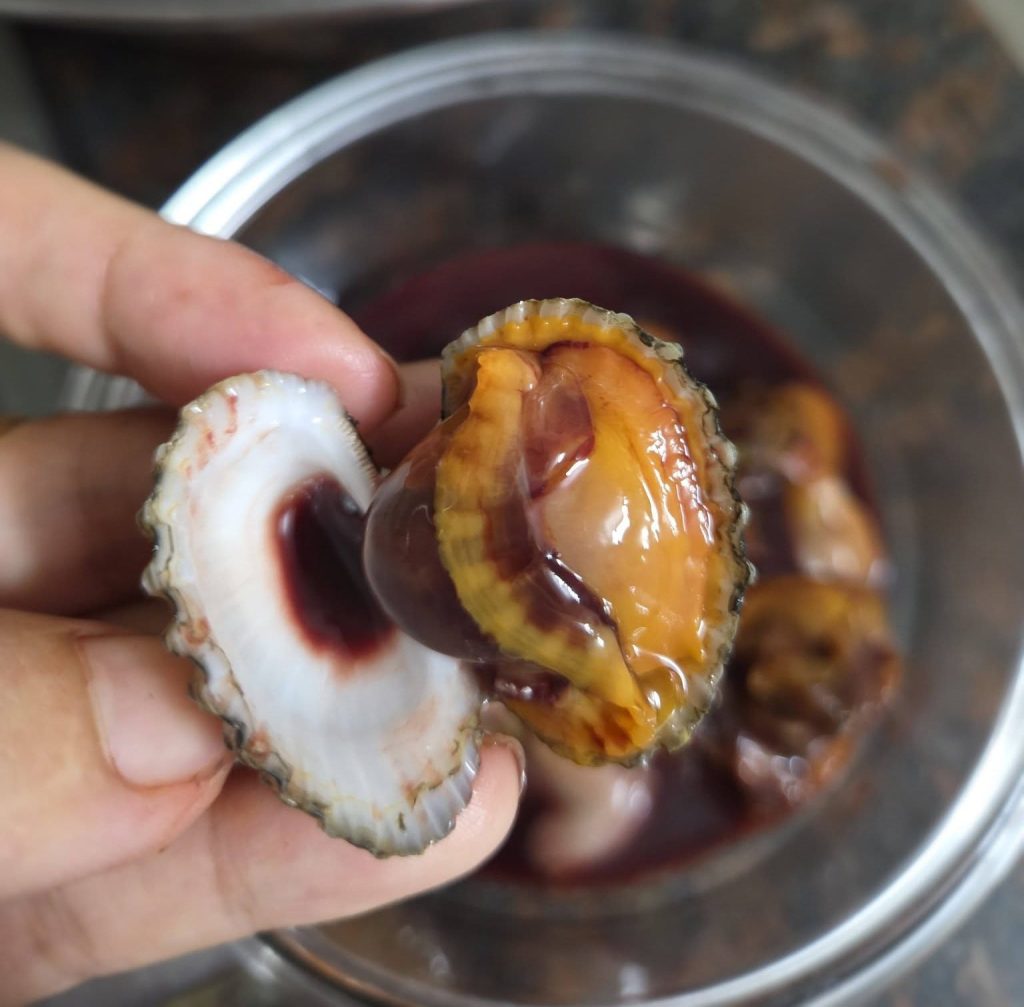 Ung thư vú HER2+ nên ăn gì, kiêng gì? Đây là những lưu ý về ăn uống bác sĩ Singapore chia sẻ với bệnh nhân… - hình minh họa 4